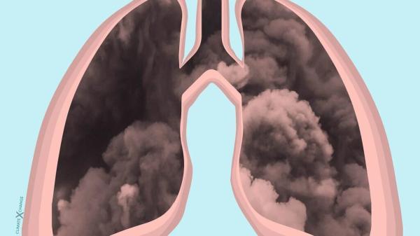 آلودگی هوا عمر ما را کوتاه می نماید
