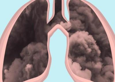 آلودگی هوا عمر ما را کوتاه می نماید